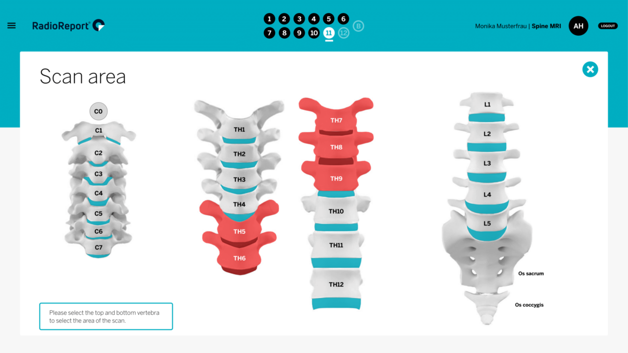 SPINE MRI MODULE | RadioReport®
