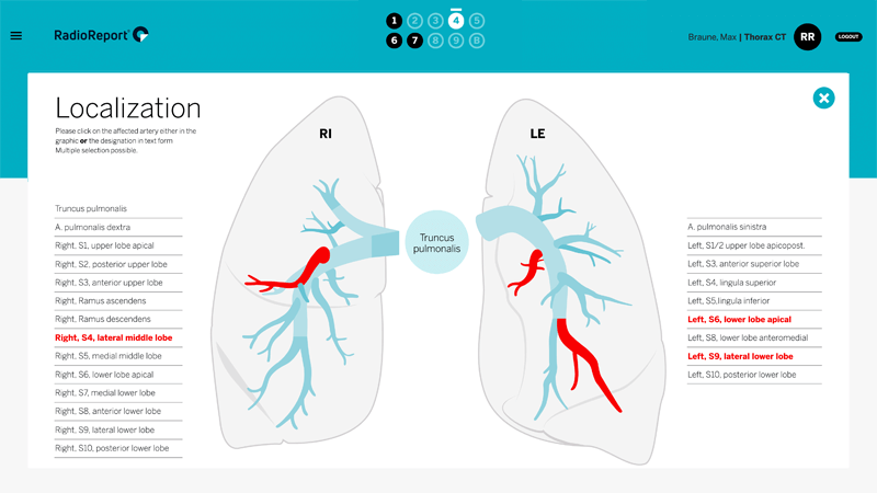 EN_thorax_thumb_ma01