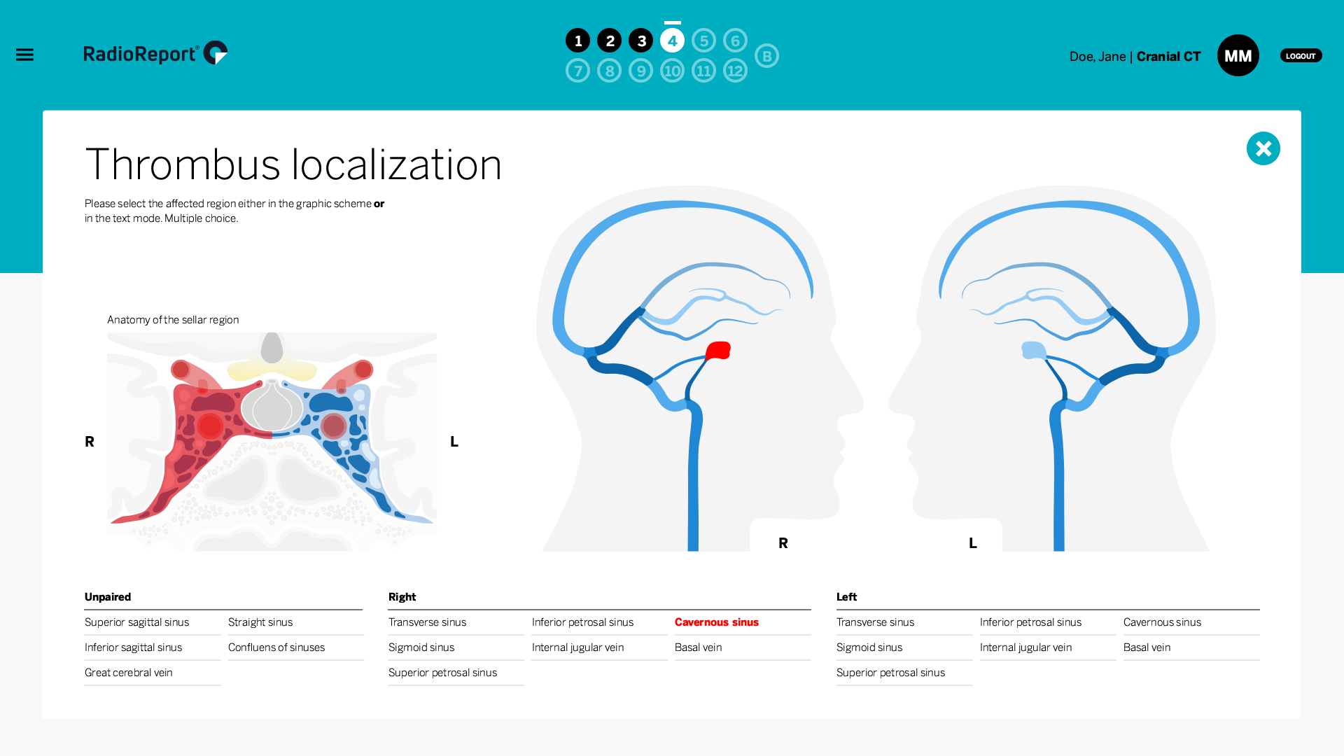 RadioReport Head MRI