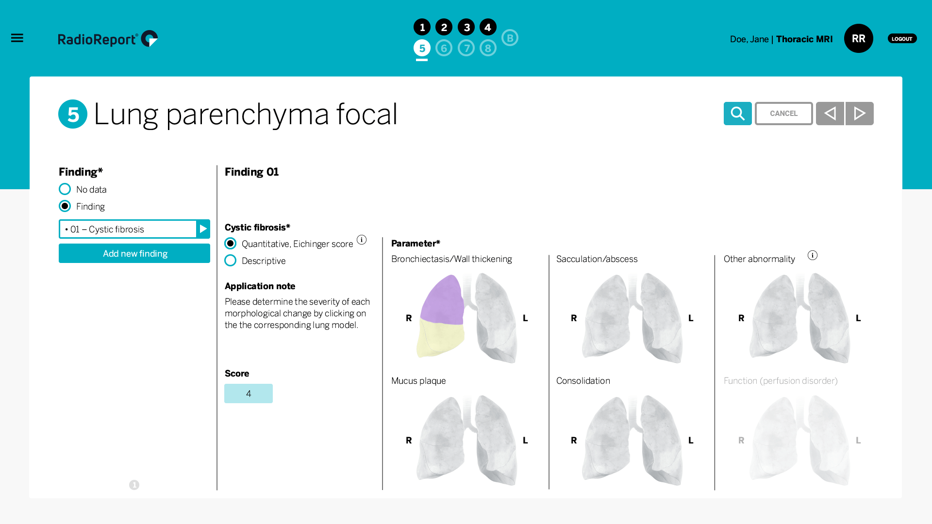 RadioReport Thorax MRT Lungenparenchym