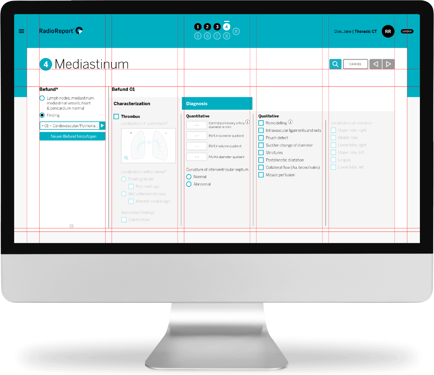 mediastinum with grid 4k