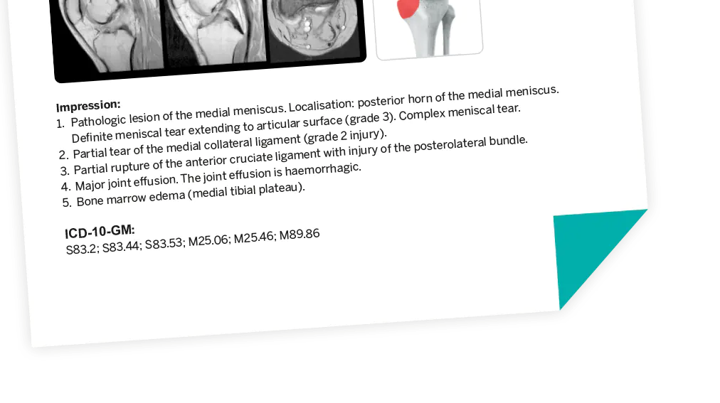 ICD-10-GM